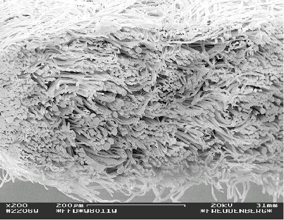 Antialerjik Yatak Kılıfı Alırken Dikkat Etmeniz Gereken 5 Kriter